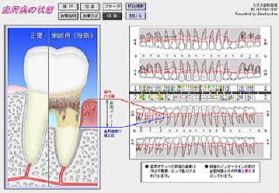 精密検査でわかるお口の状況